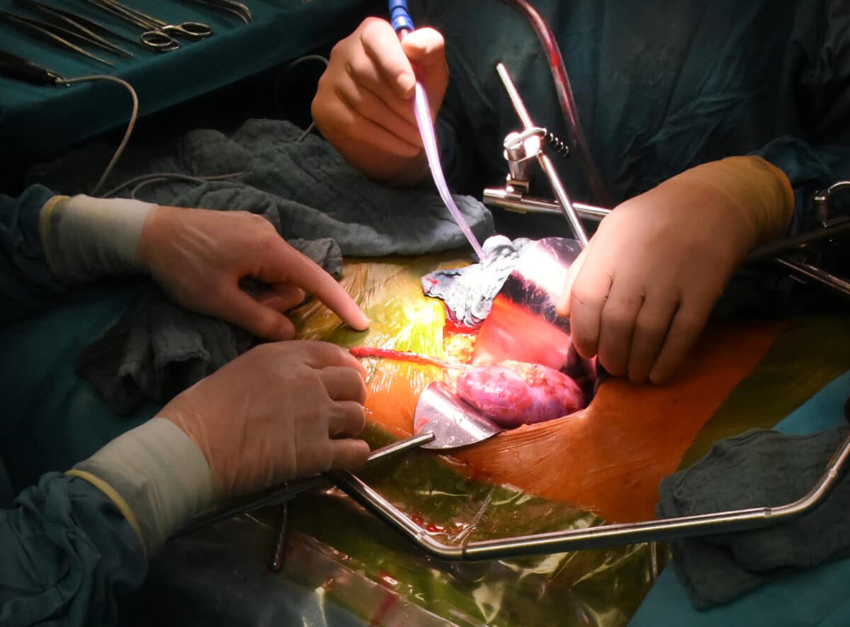 Операция по пересадке почки / © Waltraud Grubitzsch / dpa-Zentralbild / ZB