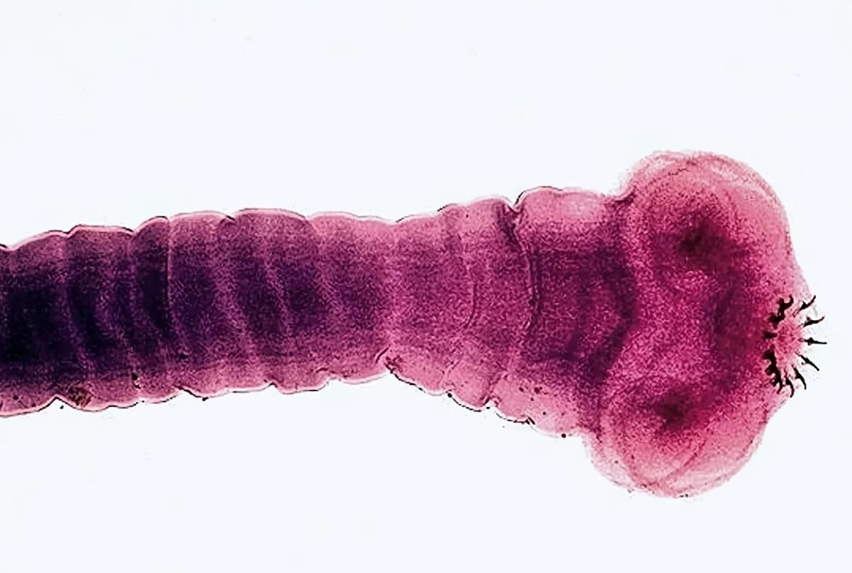 Головка ленточного червя Taenia solium / © Dr. Mae Melvin, Centers for Disease Control and Prevention (CDC) (Image Number: 1515)