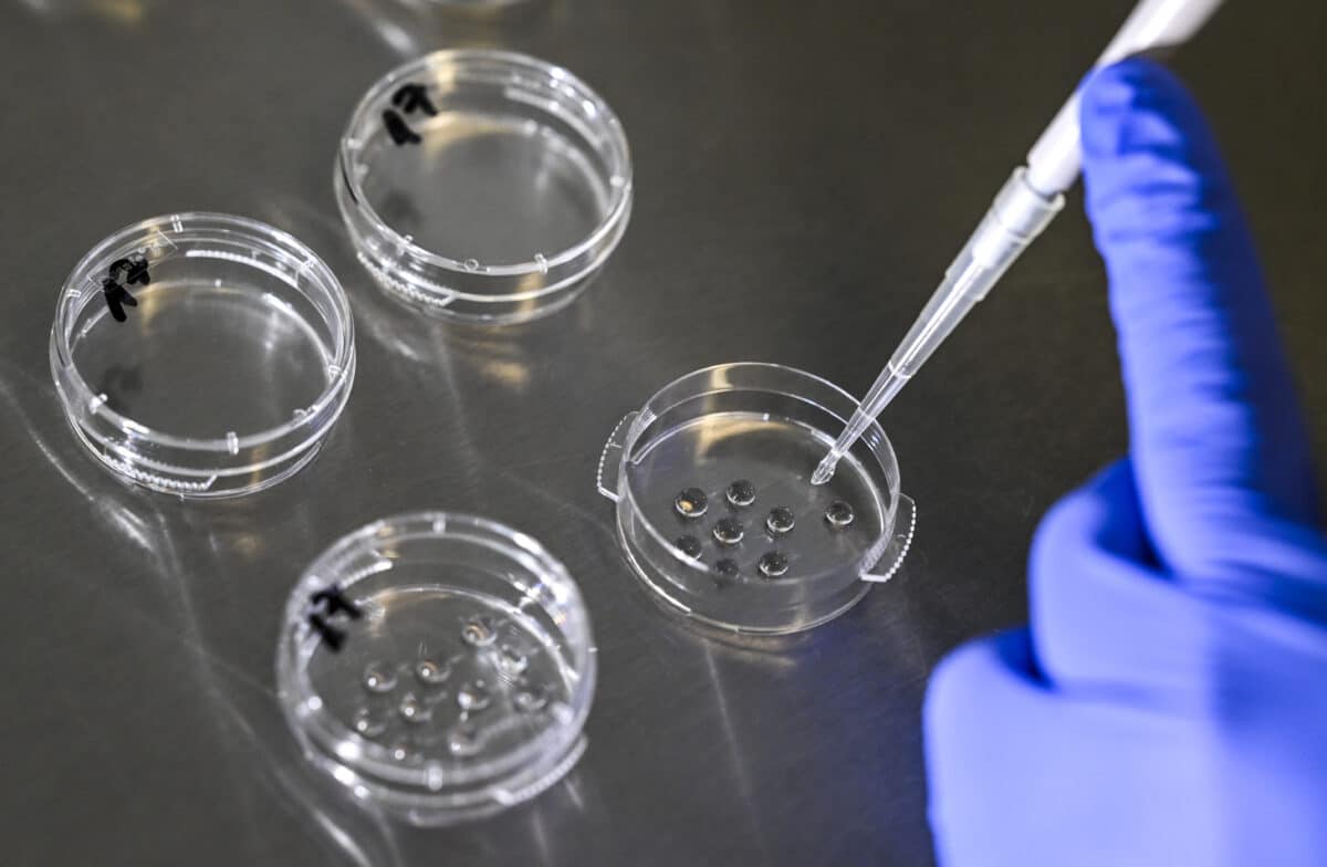 Подготовка культуральных чашек для сбора яйцеклеток после их извлечения в лаборатории Центра репродуктивной медицины в Берлине / © Jens Kalaene, dpa