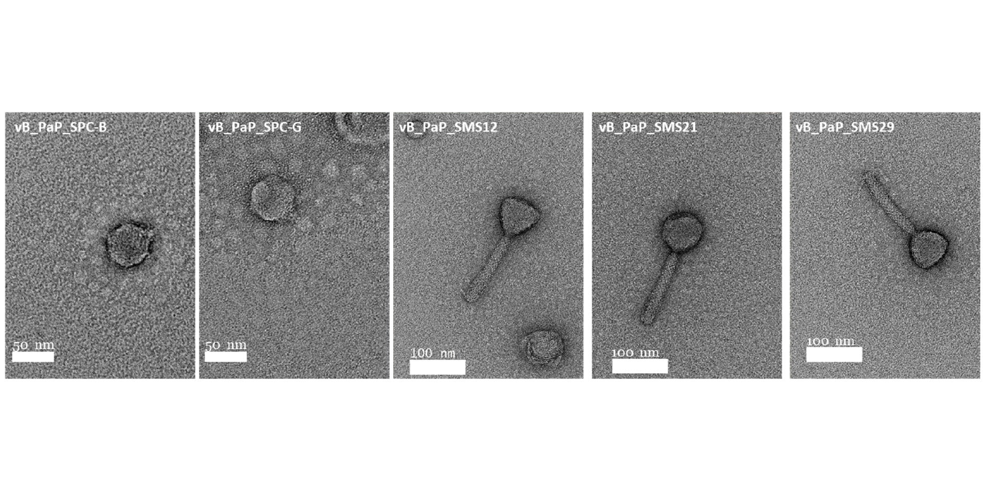 Просвечивающая электронная микроскопия вирионов различных бактериофагов синегнойной палочки / © Pinto, A.M et al., Antibiotics, DOI:10.3390/antibiotics10070877