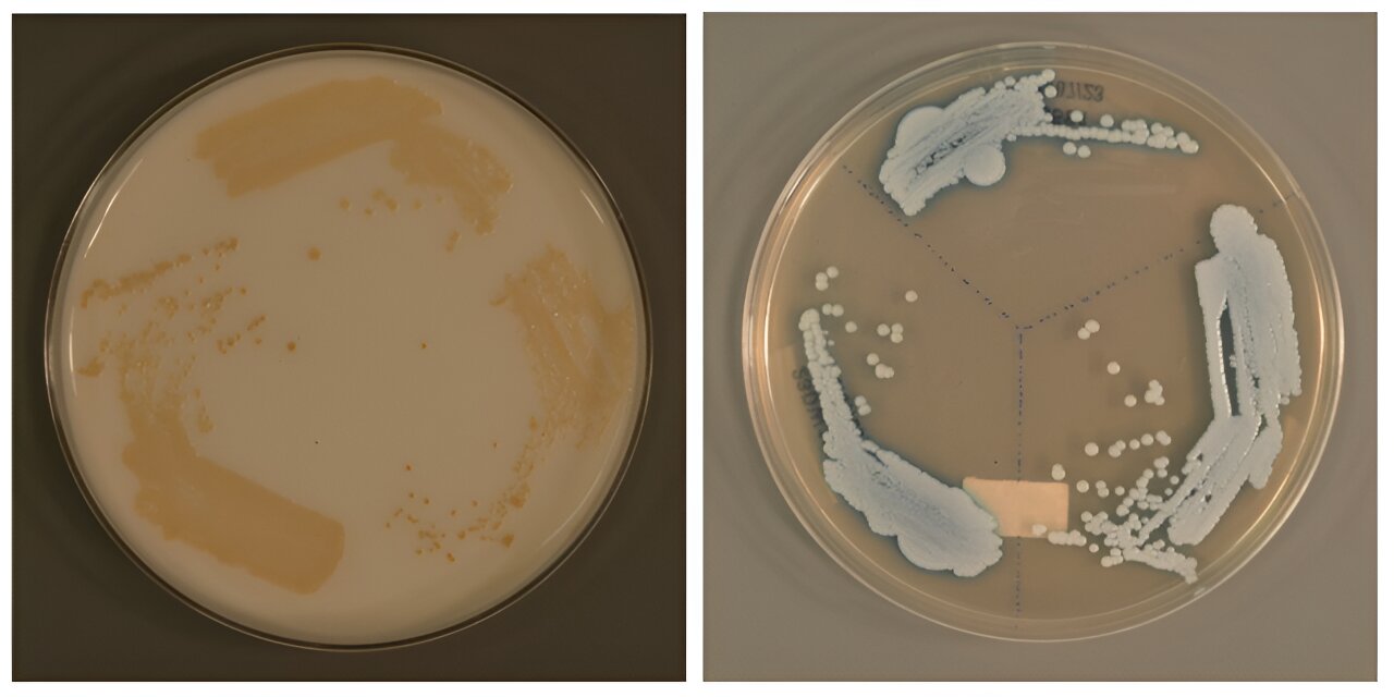 Новый тип Candida auris / © Genome Institute of Singapore (GIS)