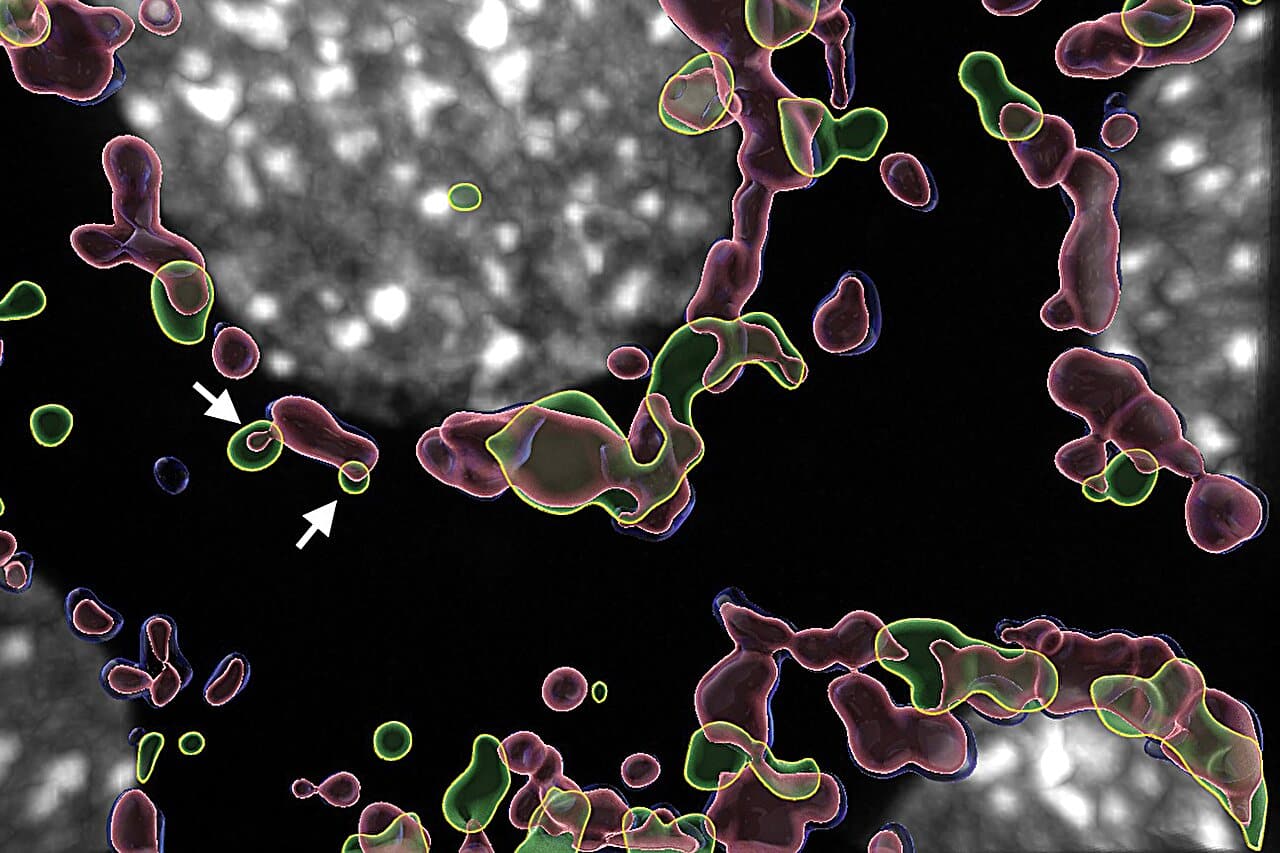 3D-реконструкция, показывающая внутреннюю митохондриальную мембрану (красную), выпячивающуюся в лизосому (зеленую). Внешняя митохондриальная мембрана показана синим цветом, а ядро ​​— серым.  / © Больница SickKids