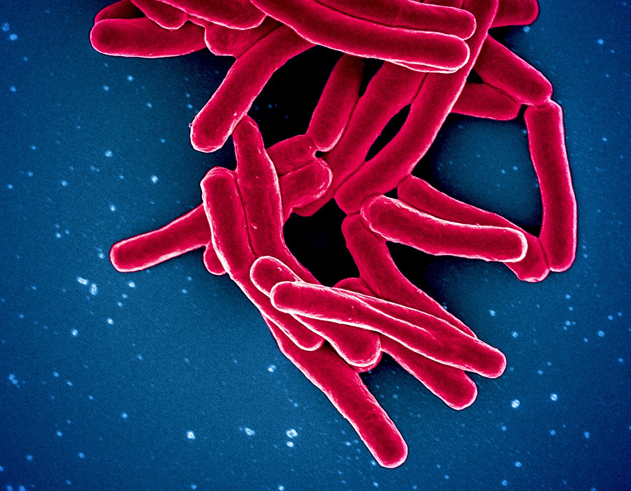 Возбудитель туберкулеза Mycobacterium tuberculosis / © wikipedia.org, NIAID