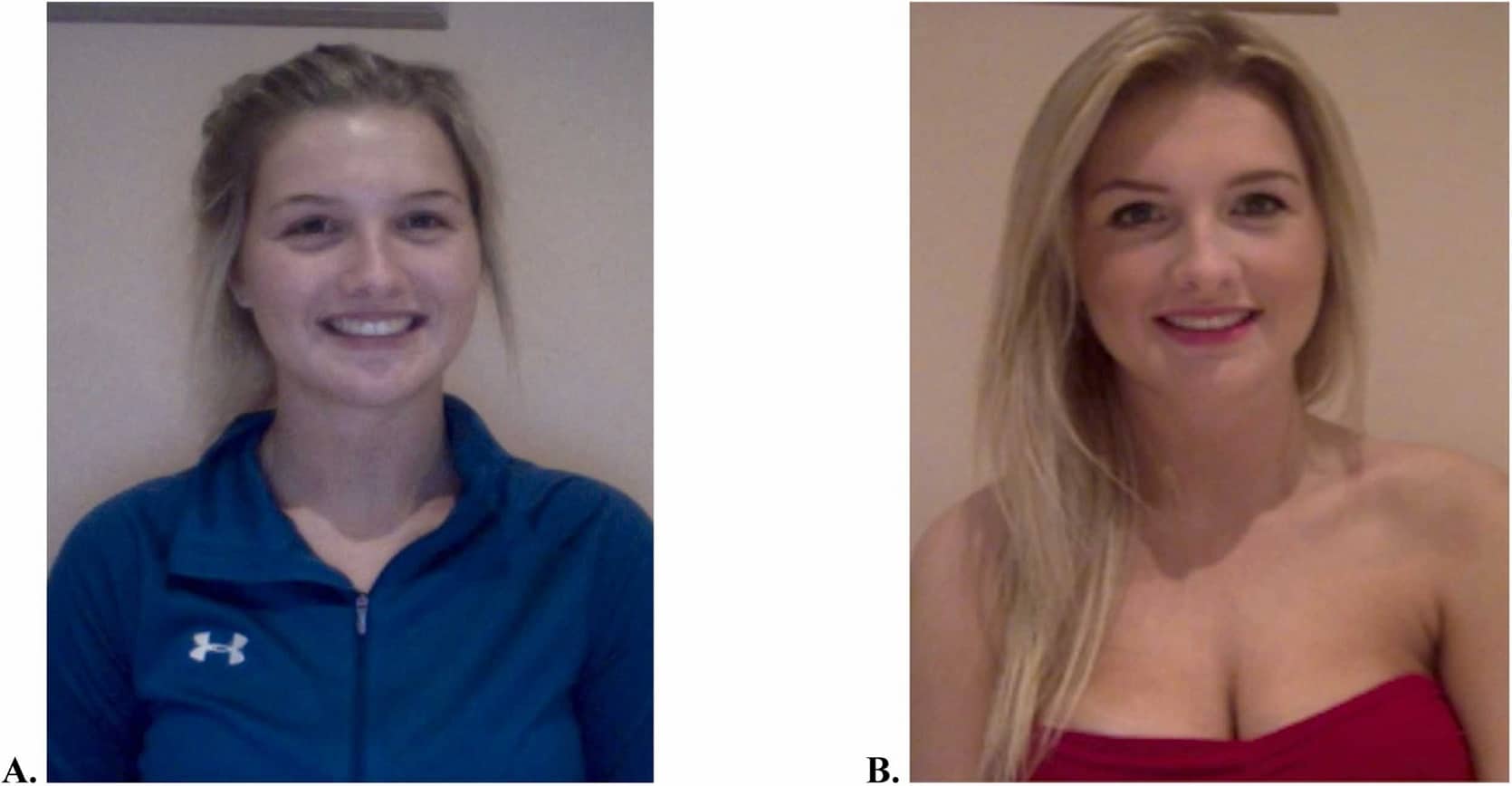 При повышенном уровне тестостерона мужчины склонны дегуманизировать женщин вне зависимости от внешнего вида / © Francesca R. Luberti, Psychoneuroendocrinology