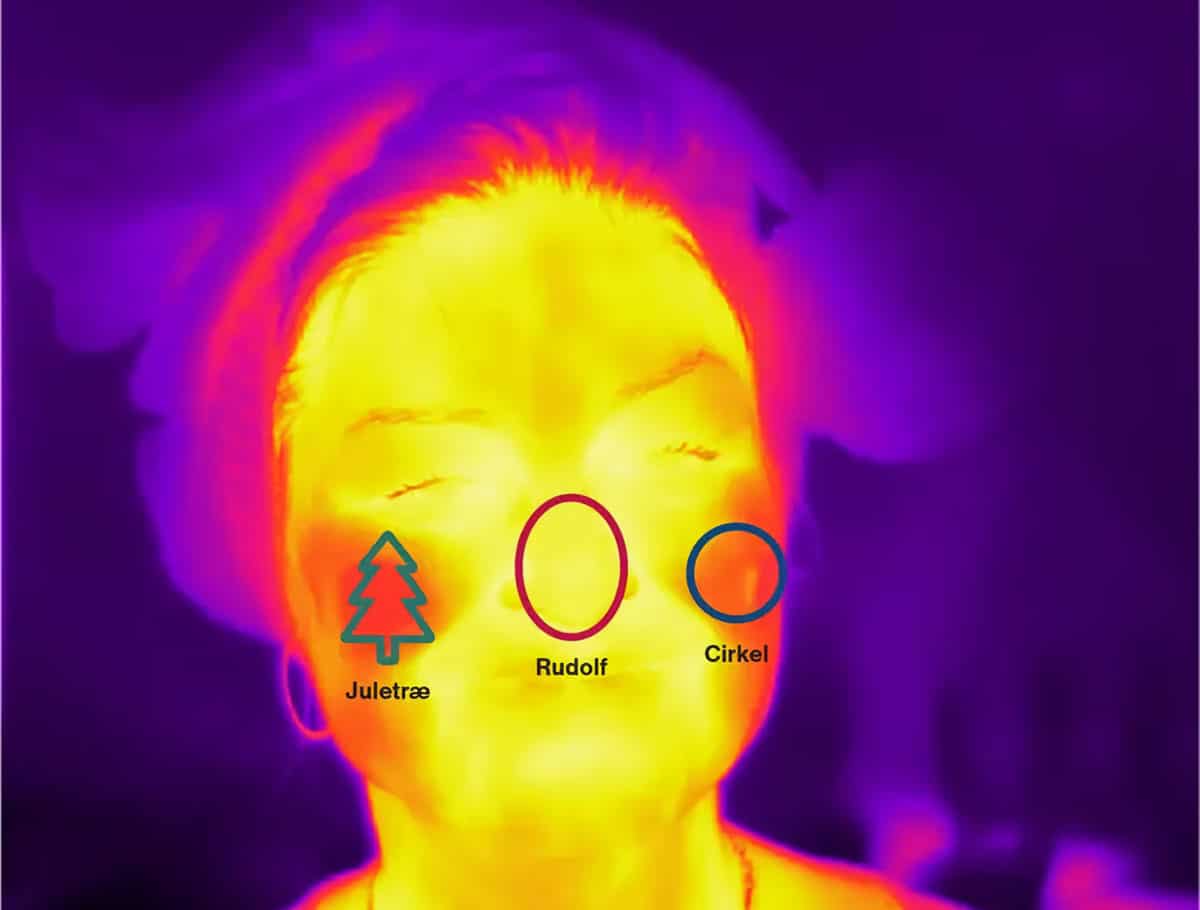 Фото, сделанное в рамках эксперимента, с измерением теплового излучения от лица. Подчеркивая шуточный оттенок работы, ученые наряду со стандартной круговой зоной ввели два своих обозначения — «зона носа Рудольфа» (по имени вымышленного оленя с красным носом из упряжки Санта-Клауса) и «зона Рождественской елки» / © Mikkel Thor Olsen, Carina Kirstine Klarskov et al., Ugeskrift for Laeger, 2024