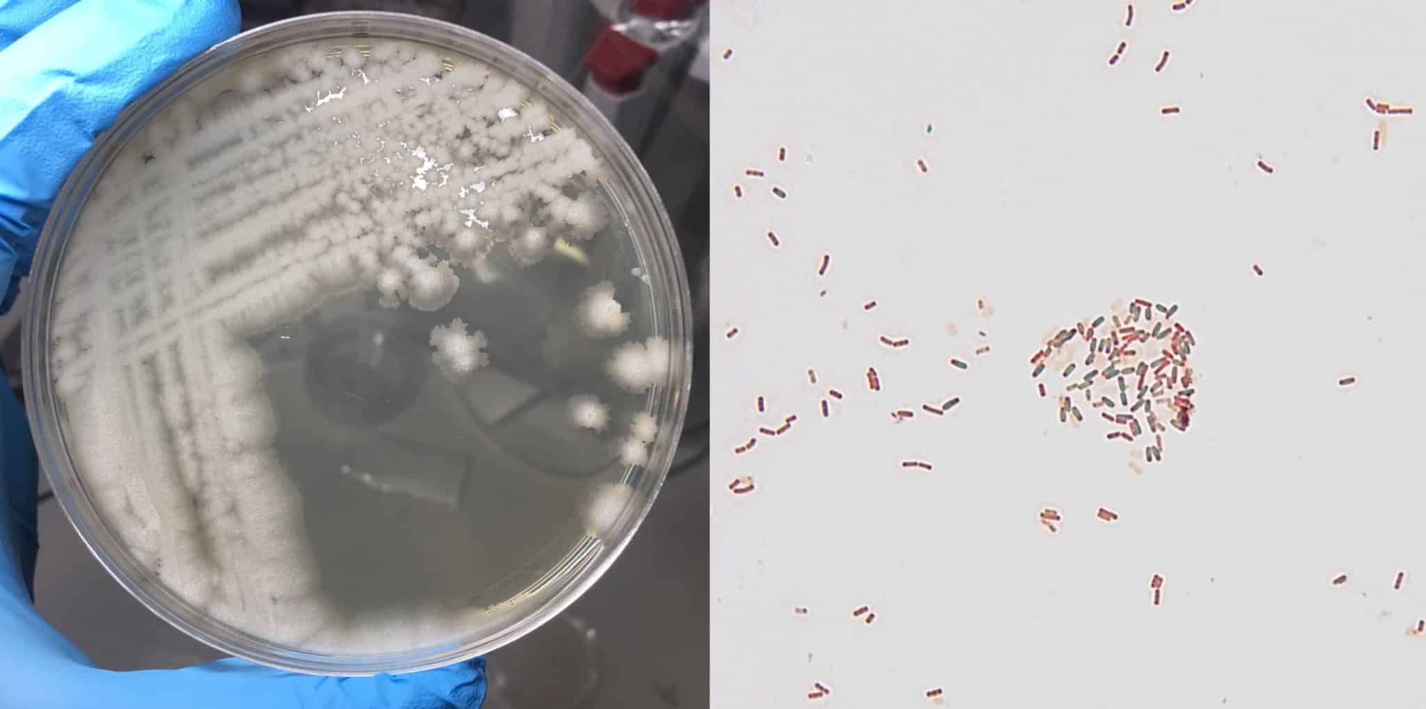 Выращенные в лаборатории колонии сенной палочки Bacillus subtilis / © Catfaster