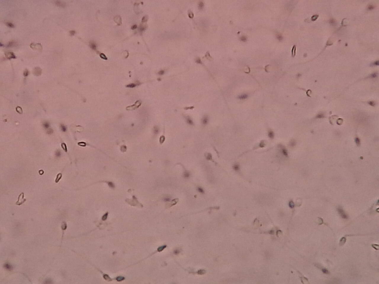 Сперматозоиды в семенной жидкости под микроскопом / © Ajay Kumar Chaurasiya, Wikimedia Commons