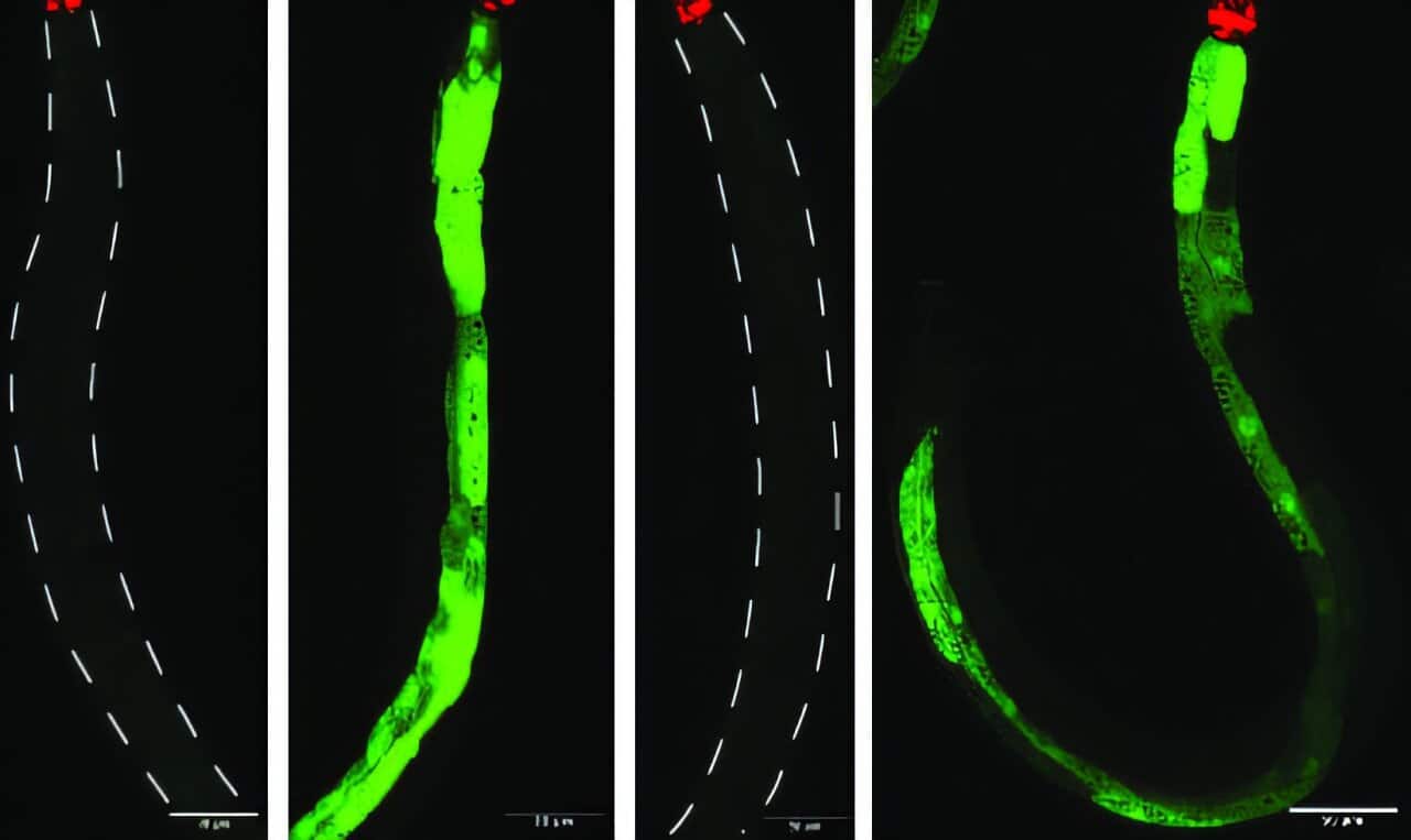 Конфокальная микроскопия, зеленым показан иммунный ответ на болезнетворную бактерию. Изображения по порядку: самка и воздействие неопасной бактерии, самка и опасная бактерия, самец и неопасная бактерия, самец и опасная бактерия Первичный иммунный ответ одинаков / © Weizmann Institute of Science