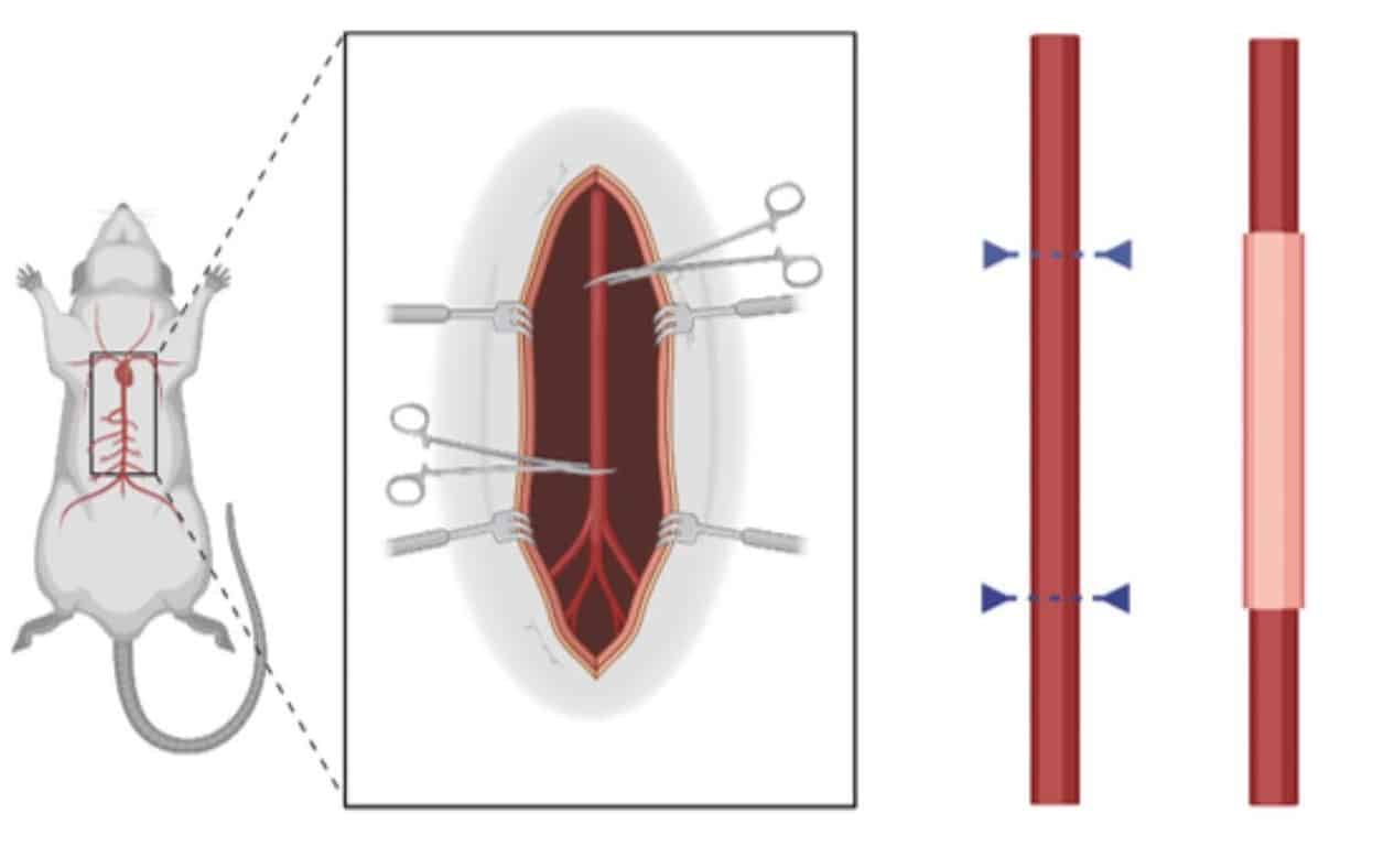 Схема метода имплантации напечатанного на 3D-биопринтере кровеносного сосуда / © Annika C. Dell et al.