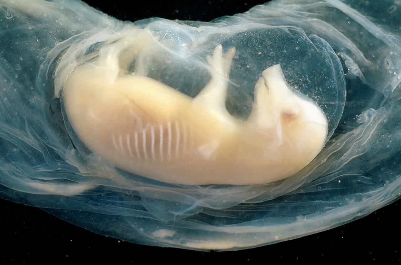 Эмбрион свиньи / © Daniel Sambraus, Science Photo Library