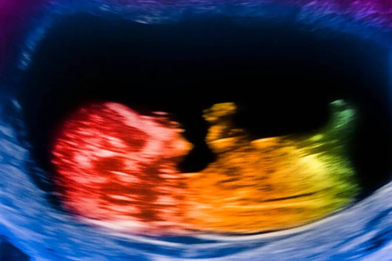 Гормоны, вырабатываемые плацентой в утробе матери, могут повлиять на развитие головного мозга / © Getty Images, Peter Dazeley