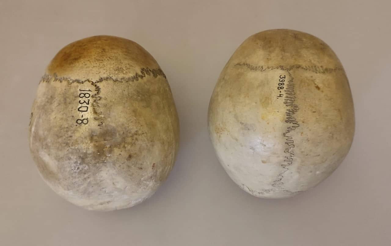 Справа череп человека 16 лет, слева — мужчины 66 лет. У второго шов между теменными костями частично зарос, но, несмотря на это, при датировании традиционными методами получалась ошибка, его возраст занижался. Новая методика позволяет избегать подобного / © Пресс-служба Российского научного фонда, Иван Широбоков