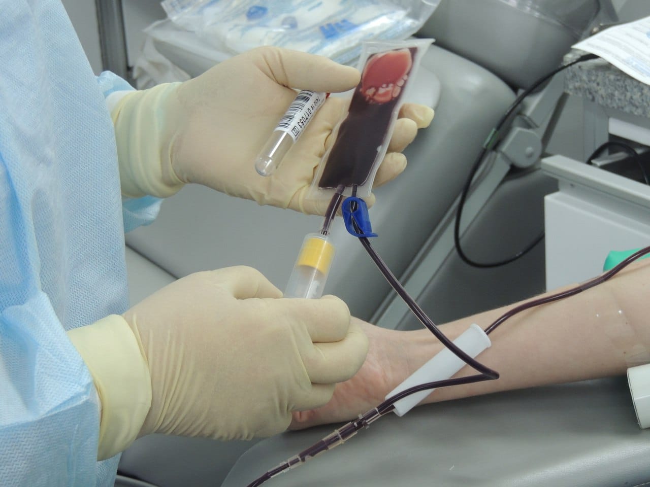 Медики сделали так, чтобы организм пациента не отторгал не полностью подходящие ему стволовые клетки / © Автор неизвестен, PxHere