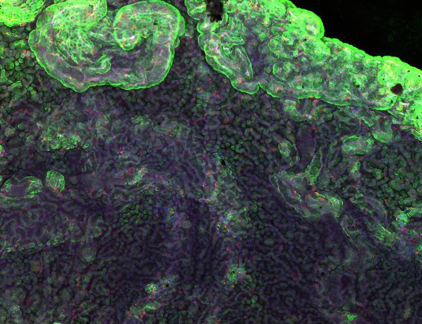 Флуоресцентное фото здорового сосудистого сплетения — основного источника спинномозговой жидкости в головном мозге / © Agnes (Yu) Luo/PNAS 2024