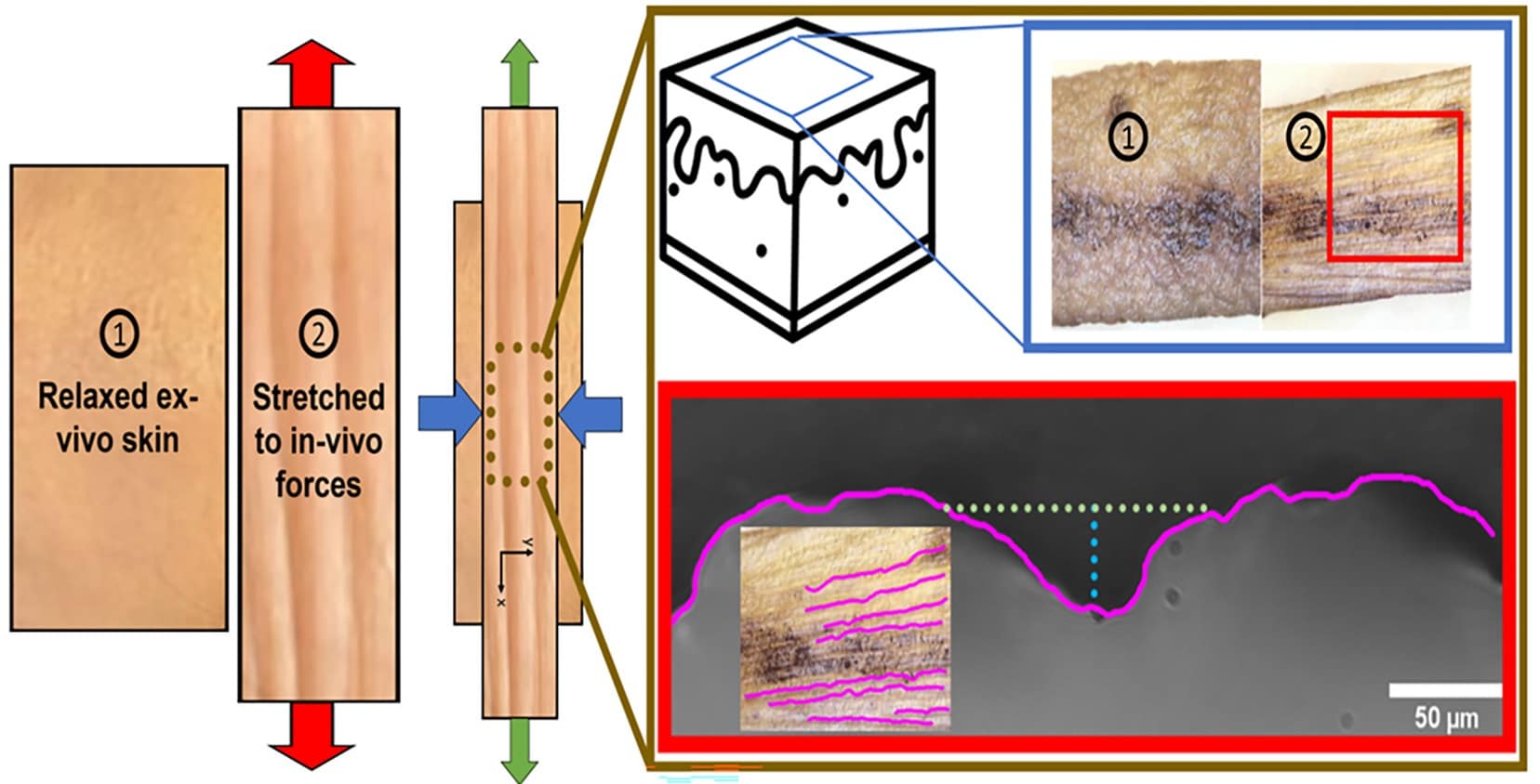 Биомедики впервые описали физический механизм возникновения морщин / © Abraham Ittycheri et al., Journal of the Mechanical Behavior of Biomedical Materials