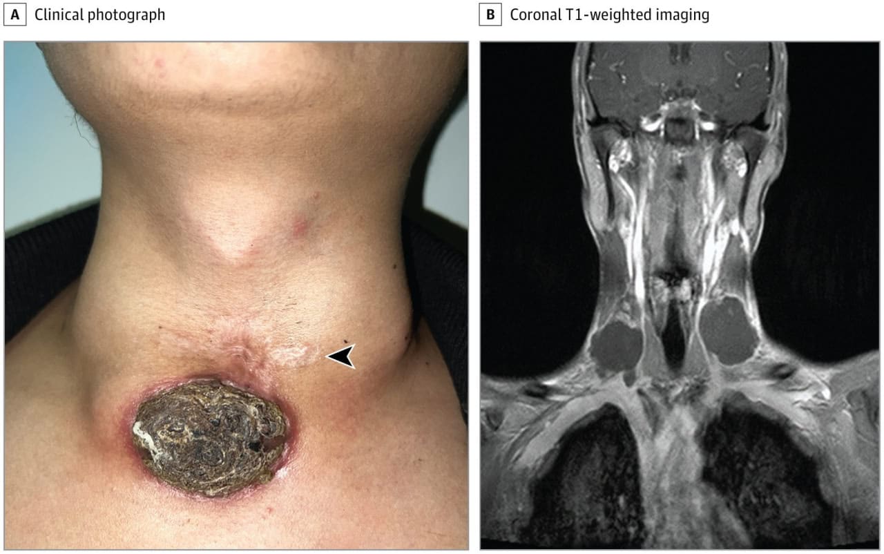 © Yang L, Li W., JAMA Otolaryngology–Head & Neck Surgery (2025)