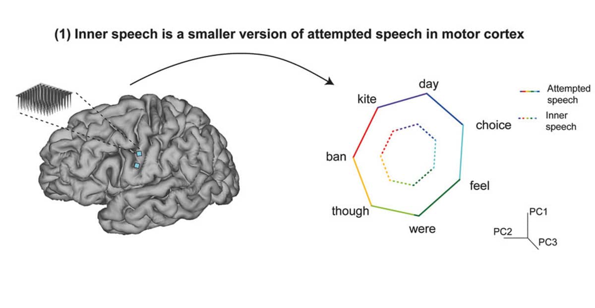 Участникам эксперимента предложили представить, что они произносят целые предложения, используя готовый набор слов. Компьютерная система смогла декодировать внутреннюю речь в режиме реального времени с погрешность от 26 до 54 процентов / © Cell