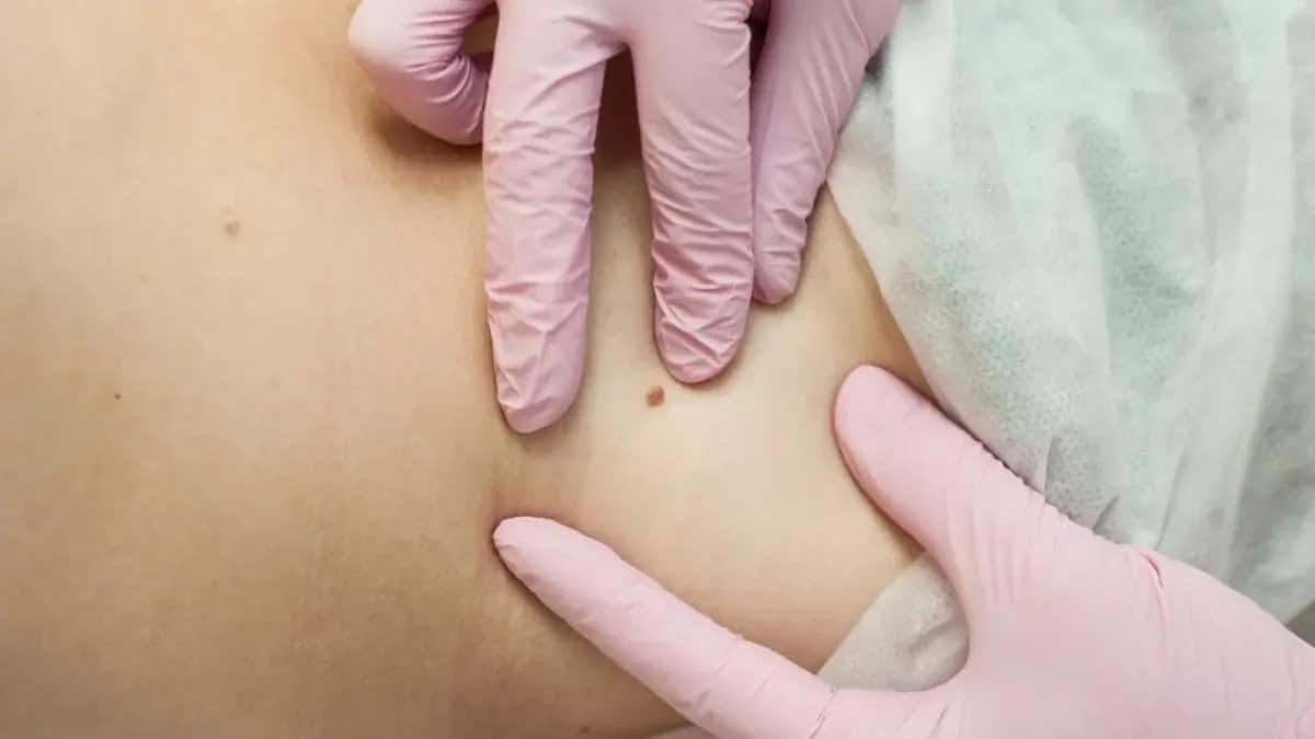 Группа вирусов папилломы человека включает 27 видов из пяти родов и более 170 штаммов. Большинство сексуально активных женщин и мужчин инфицируется различными видами ВПЧ в течение всей жизни / © ivf.uz