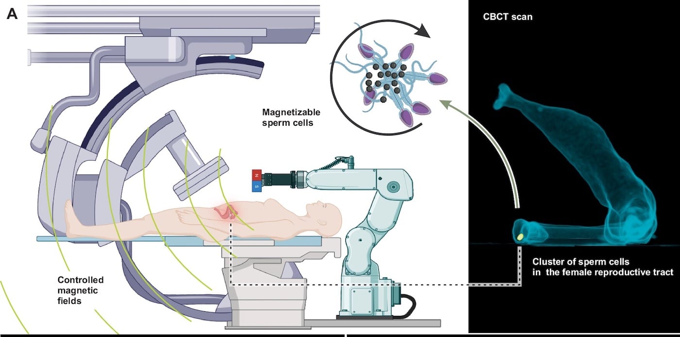 Биогибридные микророботы на основе сперматозоидов для малоинвазивного лечения женских репродуктивных органов с использованием слабых низкочастотных контролируемых внешних магнитных полей и рентгеновской флюороскопии для локализации кластеров намагничивающихся сперматозоидов / © Veronika Magdanz et.al./npj Robotics (2025). DOI: 10.1038/s44182-025-00044-1