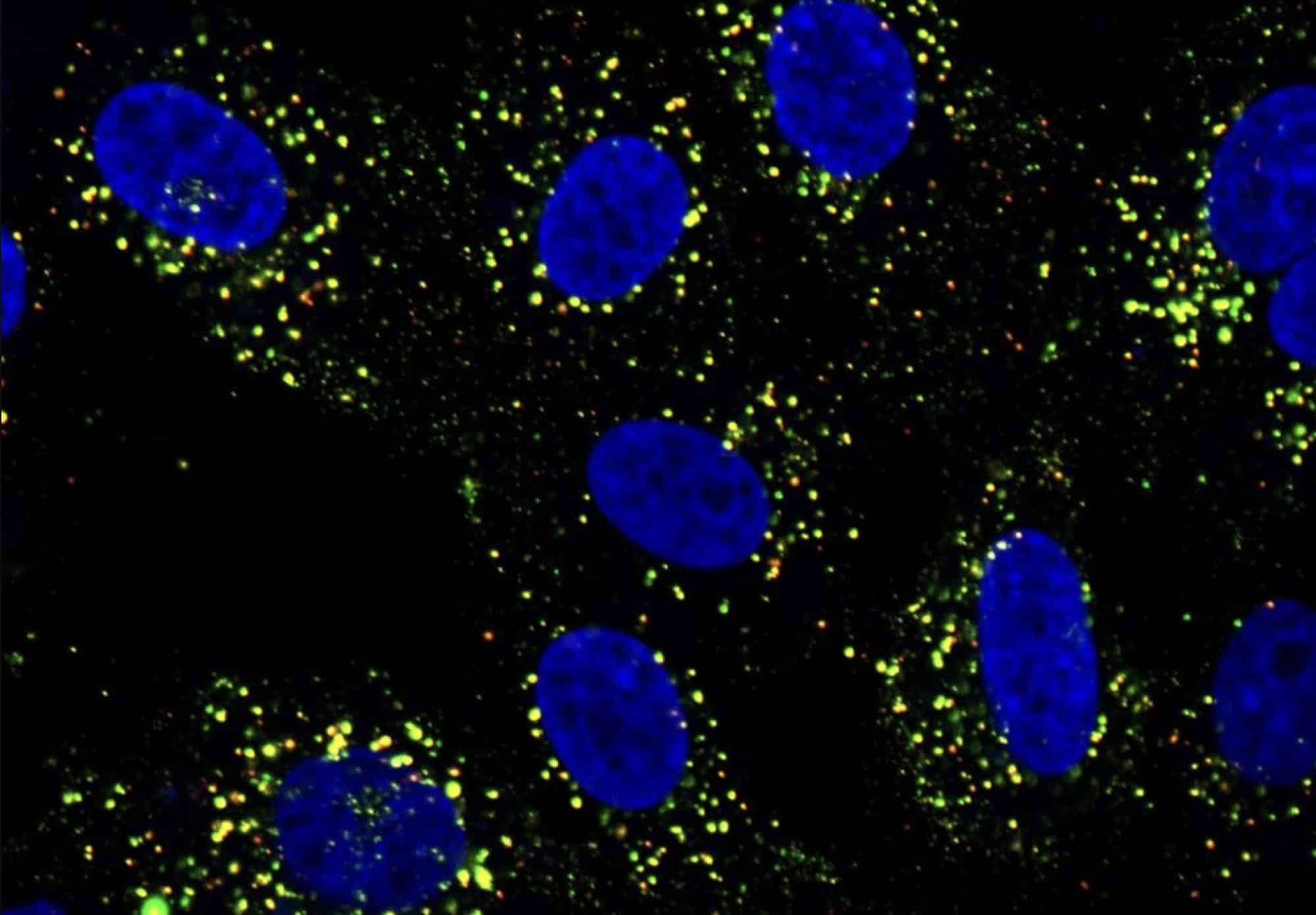Клетки человека, зараженного лихорадкой денге под флуоресцентным микроскопом. Синим отмечены ядра, зеленым и красным — вирусные компоненты и белки клеточного ответа. / © Summer Zhang, Duke-NUS Medical School
