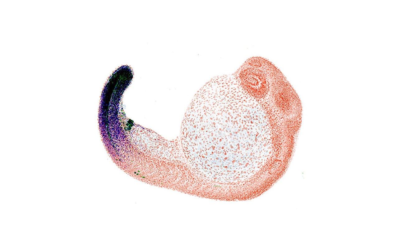 Экспрессия гена Hox13 в эмбрионе рыбки данио-рерио. / © Nature (2025). DOI: 10.1038/s41586-025-09548-0