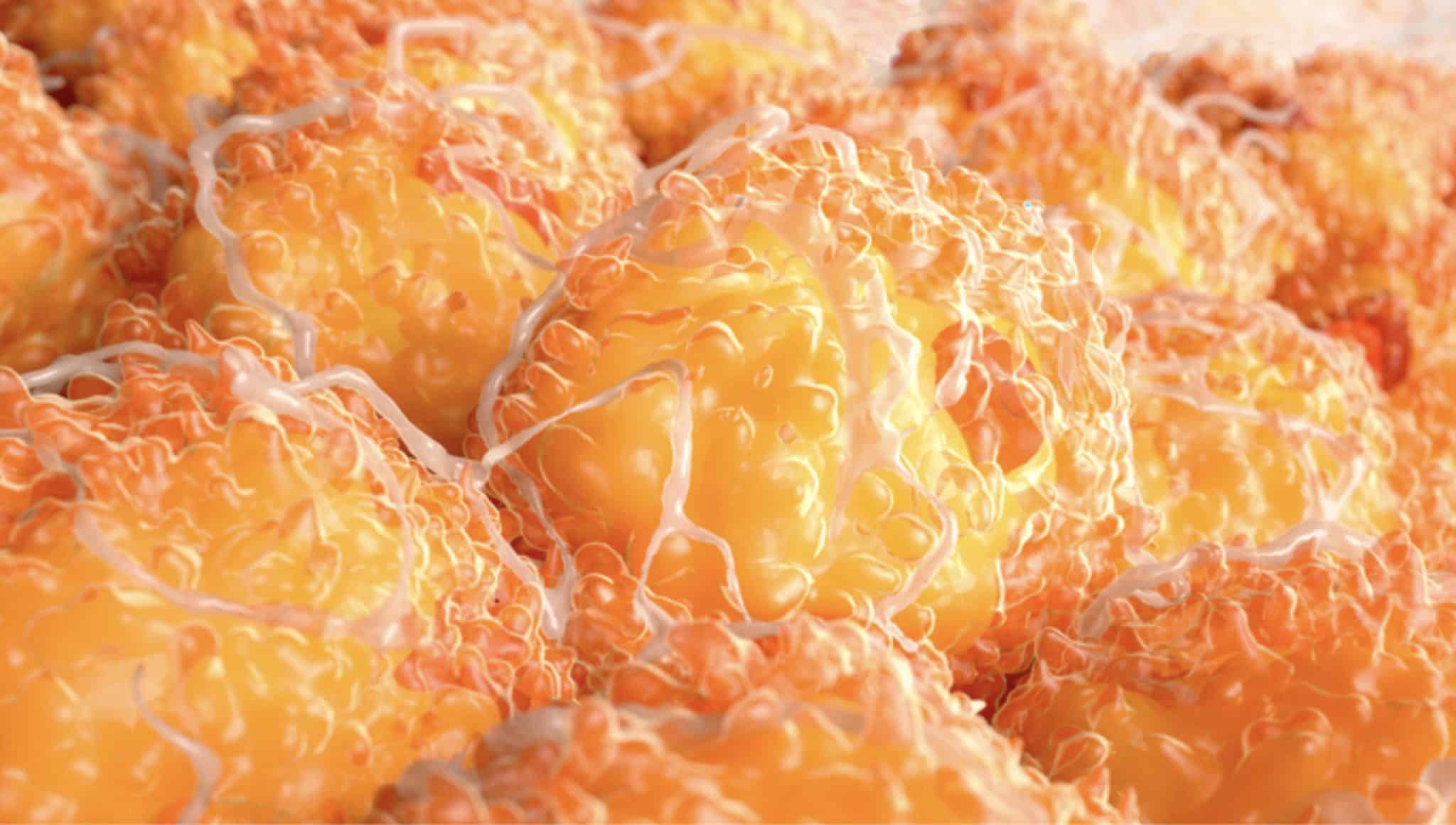 3D-визуализация клеток жировой ткани (адипоцитов), которые накапливают и хранят энергию в виде жира. Ярко-оранжевые структуры — это клетки, заполненные жировыми каплями, а переплетающиеся белые нити — сеть кровеносных сосудов и соединительной ткани, окружающей и питающей питает жировую ткань. / ©  Juan Gaertner/ Science Photo Library/ Getty Images