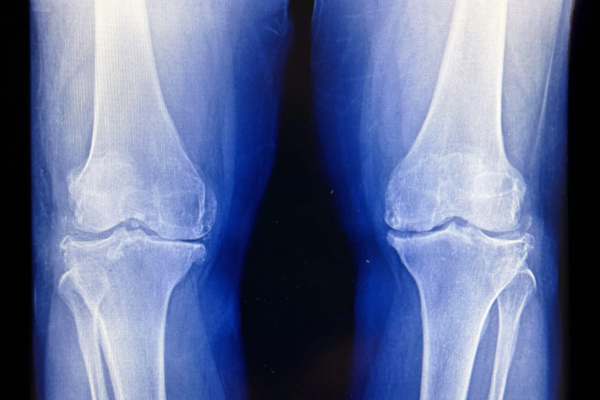 Снимок коленей человека / © Wikimedia Commons