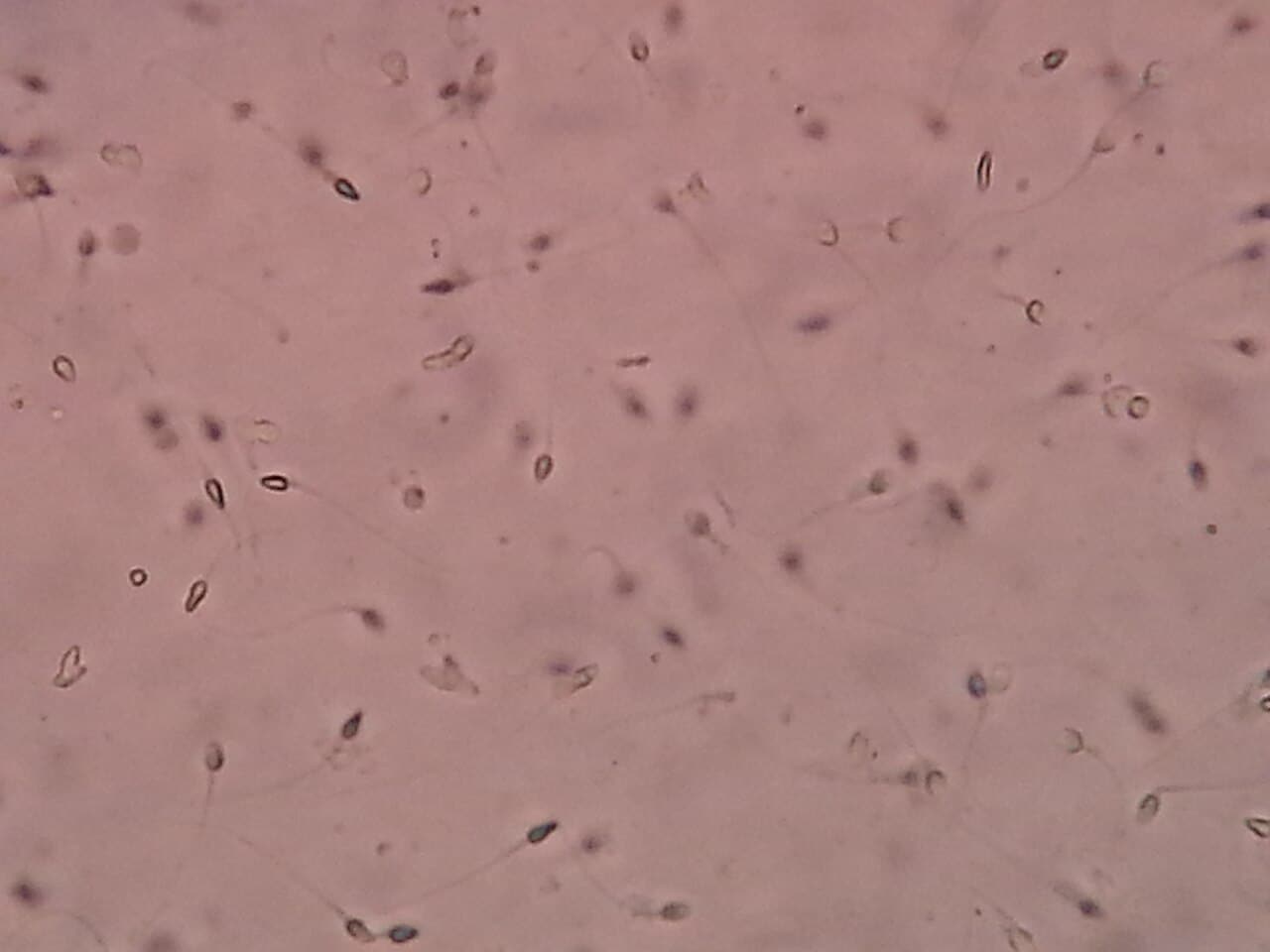 Микрофотография спермы / © Ajay Kumar Chaurasiya