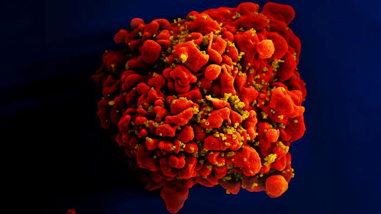 Т-клетка (красный), заражаемая ВИЧ (желтый). Изображение полученное сканирующим электронным микроскопом / © NIAID