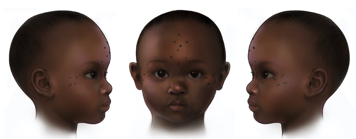 Реконструкция татуировки на лбу трехлетней девочки из Кулубнарти / © Mary Nguyen / UMSL; Anne Austin et al. / PNAS (2025)