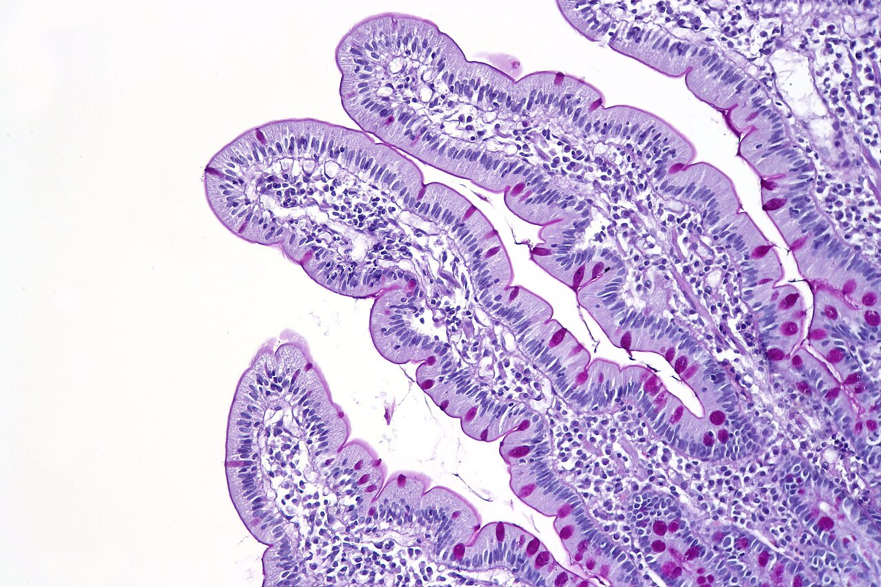 Ворсинки в двенадцатиперстной кишке / © CoRus13