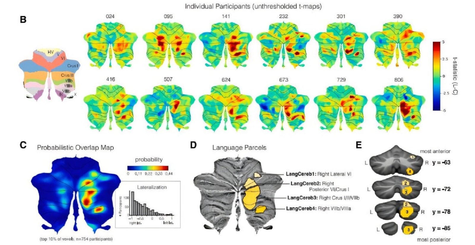 В мозжечке нашли область, которая отвечает исключительно за обработку речи / © Colton Casto et al., Neuron