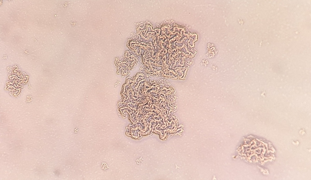 Колонии микобактерий из образца мокроты / © tloh2 / iNaturalist