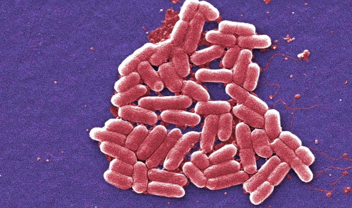 Escherichia coli, сканирующая электронная микроскопия. / © James Joel / Flickr
